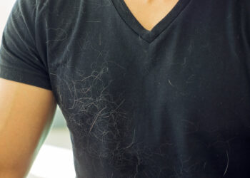 Easy tricks to remove pet hair from your clothes